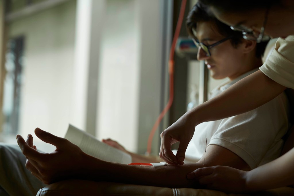 IV Drip with Acupuncture
