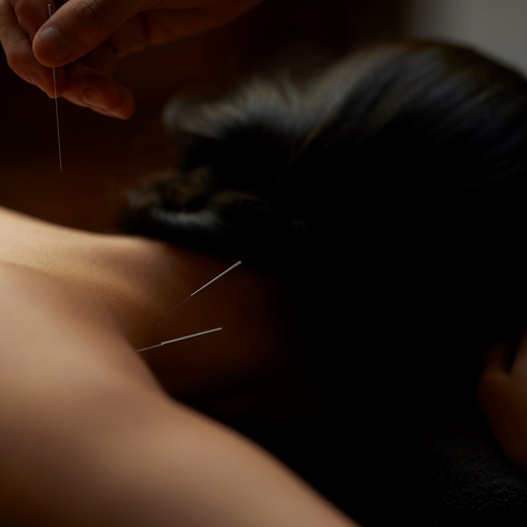 RAKxa Acupuncture TCM